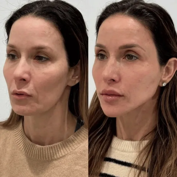 SheVitality ProGlow GHK-Cu Face Mask